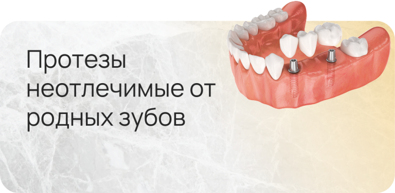 протезы1